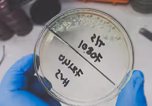 Enterococcus colony bacteria culture growth on a petri dish. What are fecal indicator bacteria?